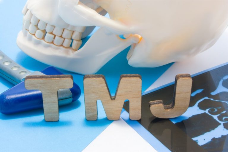When Should You Seek Professional Help for TMJ Issues?